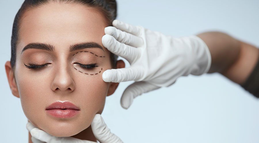 Blefaroplastia